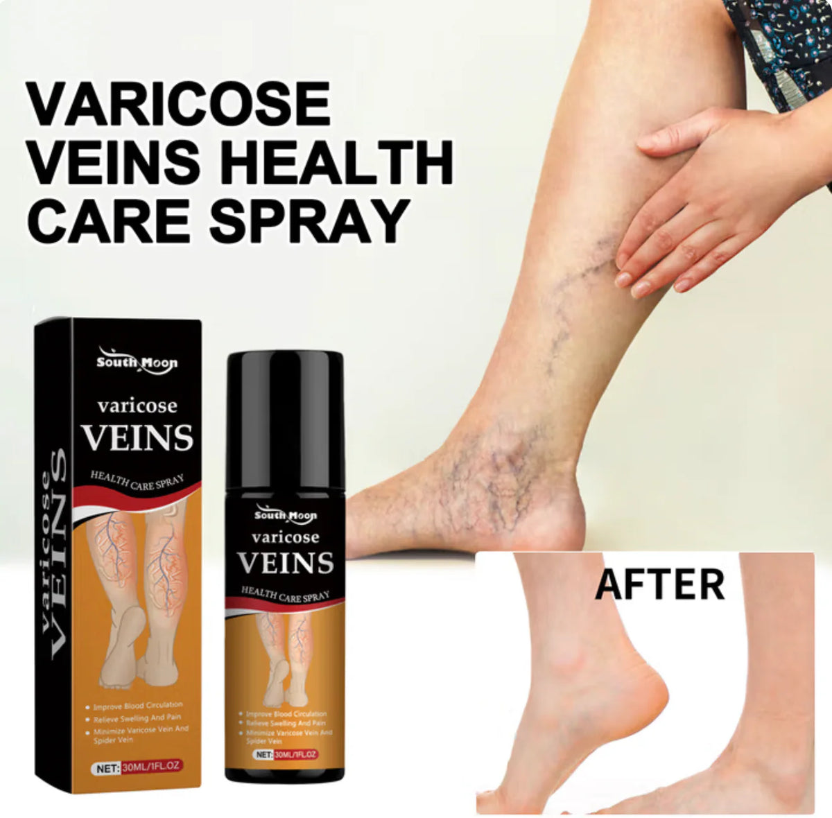 Turmeric Varicose Vein Relief Spray