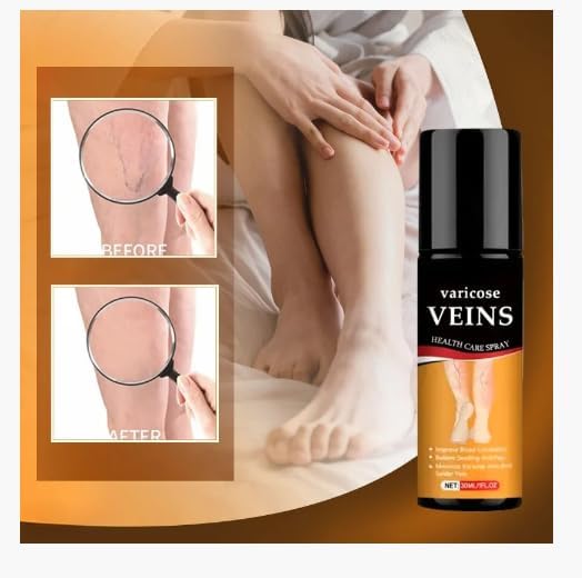 Turmeric Varicose Vein Relief Spray