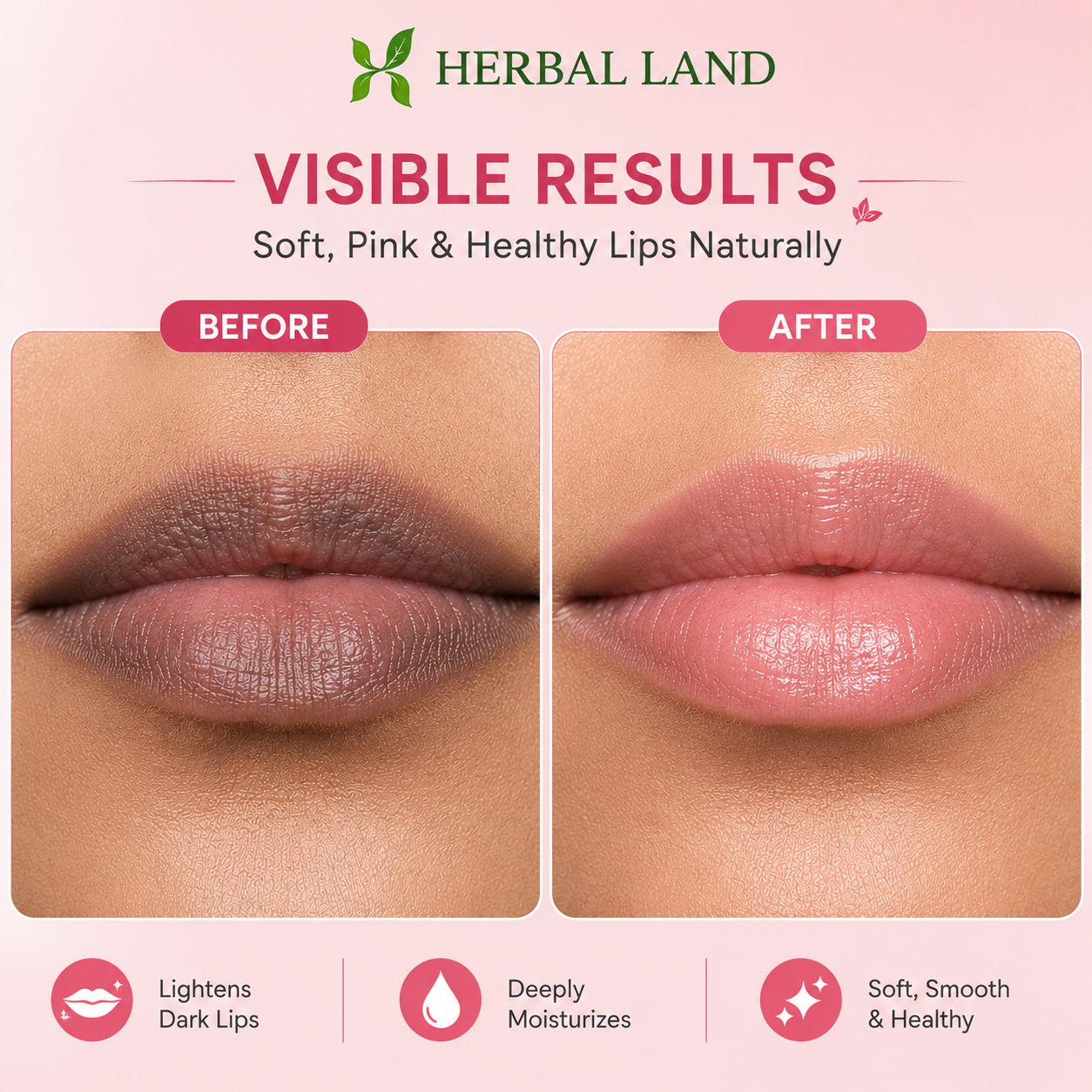 Herbal Dark Lip Repair Cream โ Natural Care for Soft & Beautiful Lips