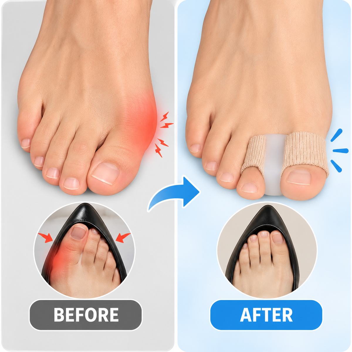 Soft Gel Bunion Corrector & Toe Spacer