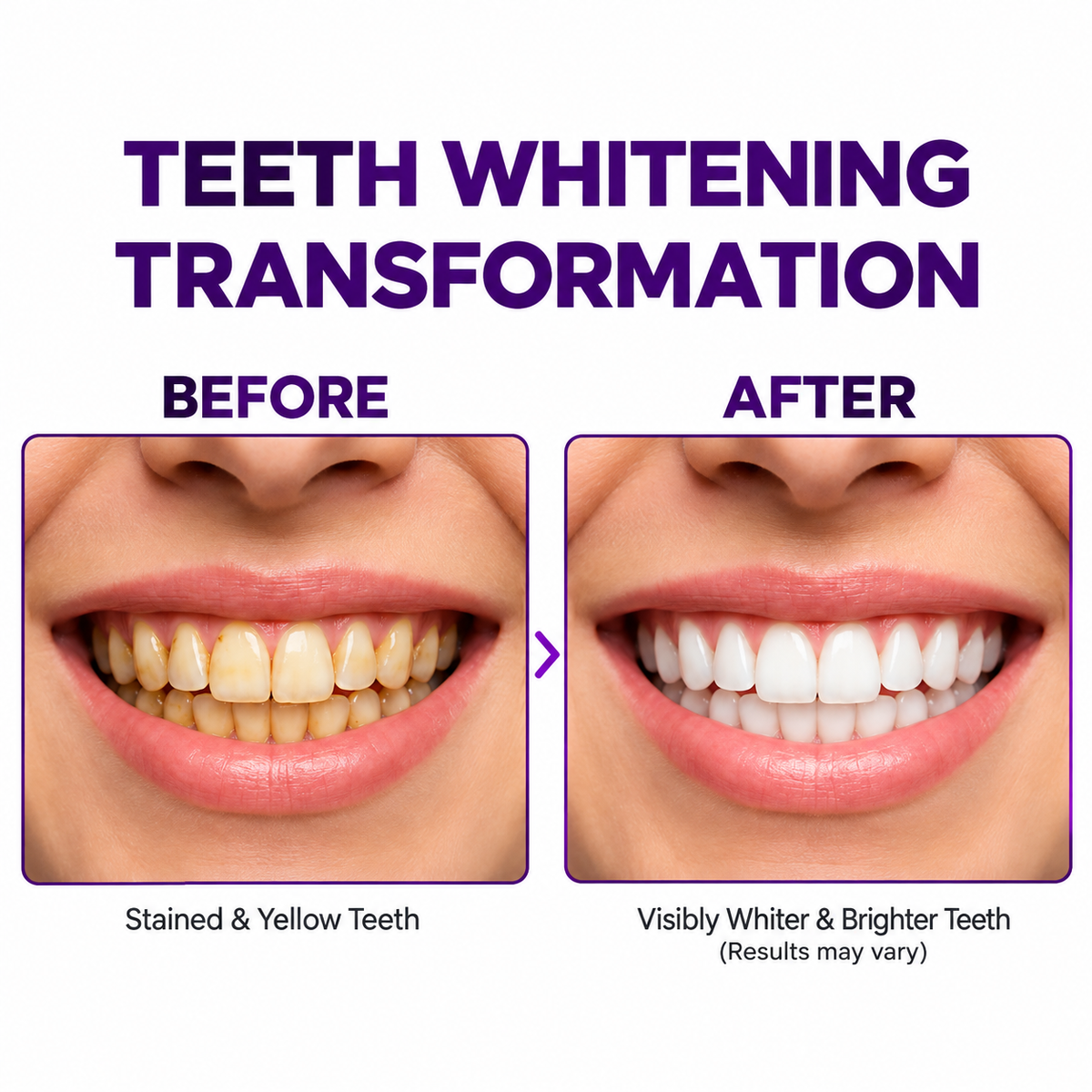 Herballand™ Purple Teeth Whitening Strips