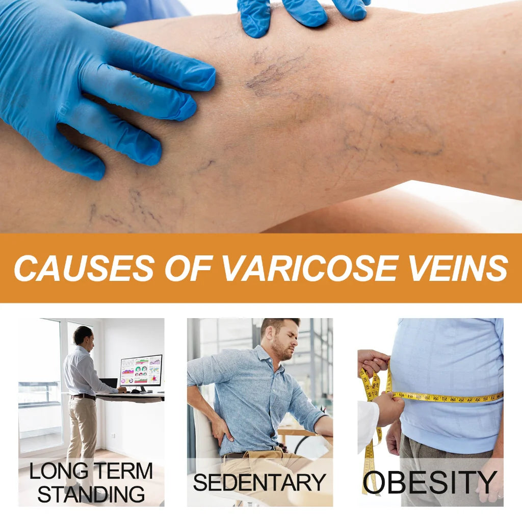 Turmeric Varicose Vein Relief Spray