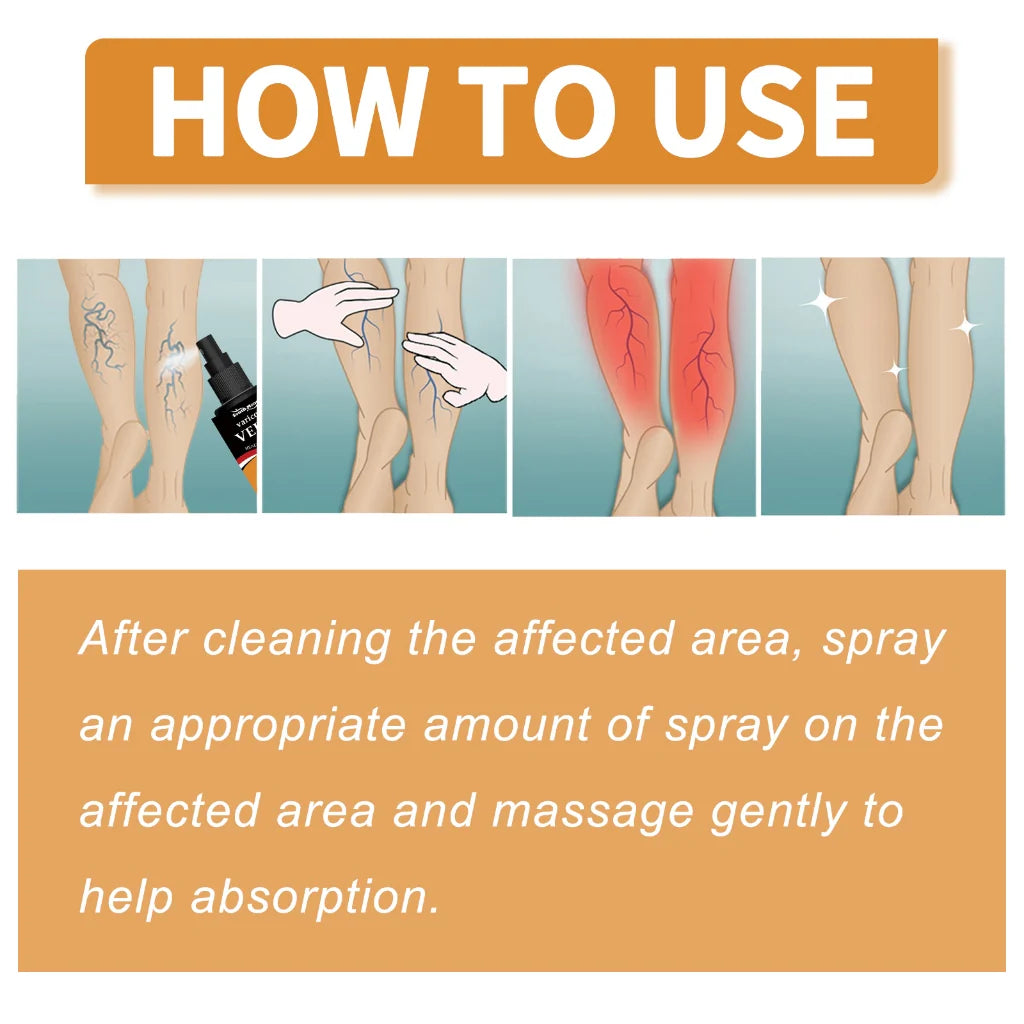 Turmeric Varicose Vein Relief Spray