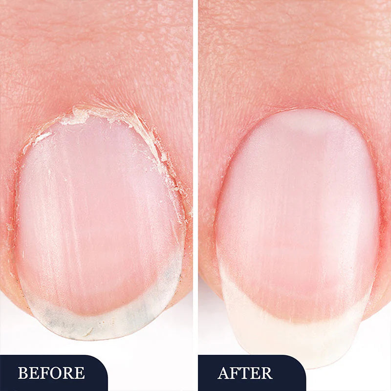 2 In 1 Herbal Nail Fungus Repair Pen