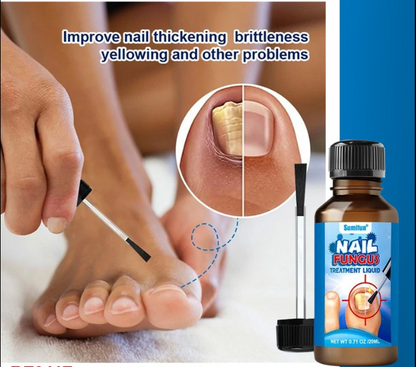 Herbal Anti-Fungal Nail Liquid