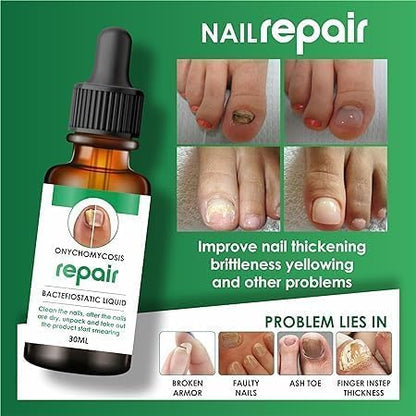 Nail Serum for Repair & Growth