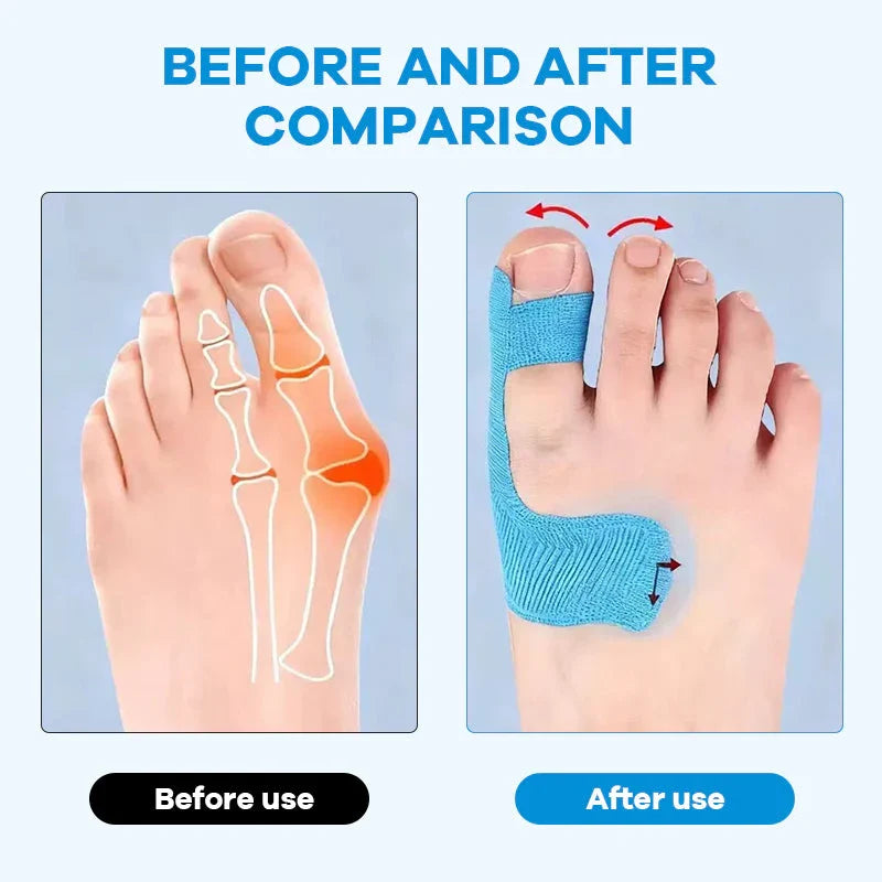 2-in-1 Orthopedic Bunion Relief & Toe Alignment Tape
