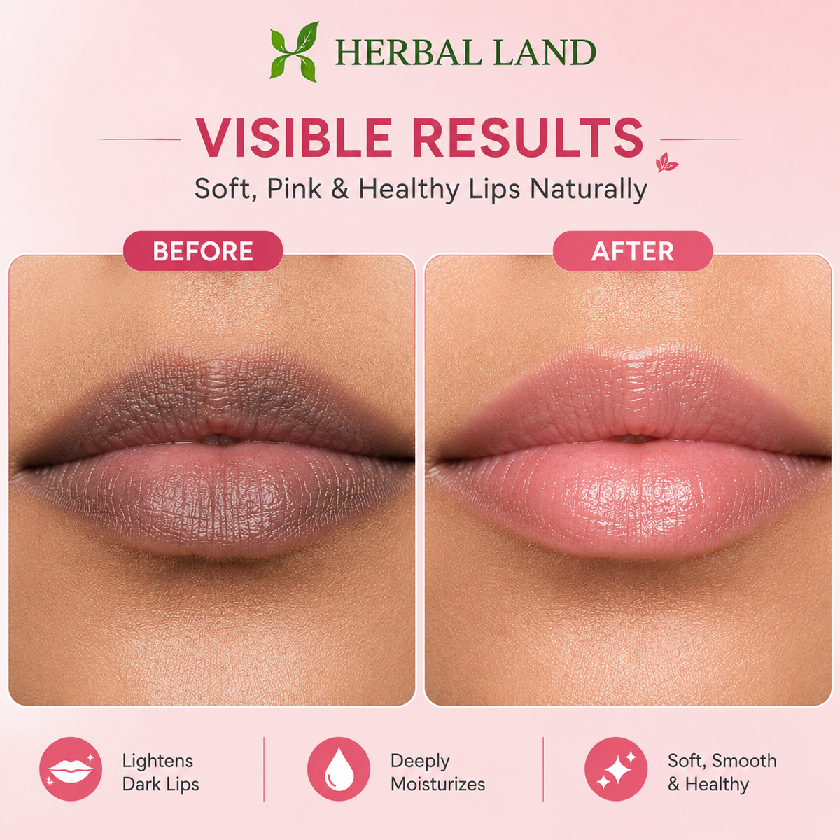 Herbal Dark Lip Repair Cream – Natural Care for Soft & Beautiful Lips