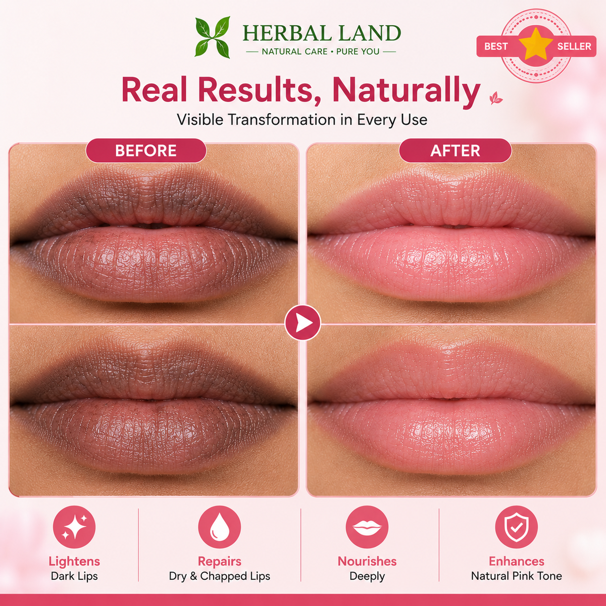 Herbal Dark Lip Repair Cream – Natural Care for Soft & Beautiful Lips