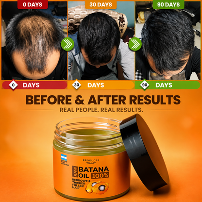 3-in-1 Batana Hair Oil For Hair Growth, Strength & Thickness