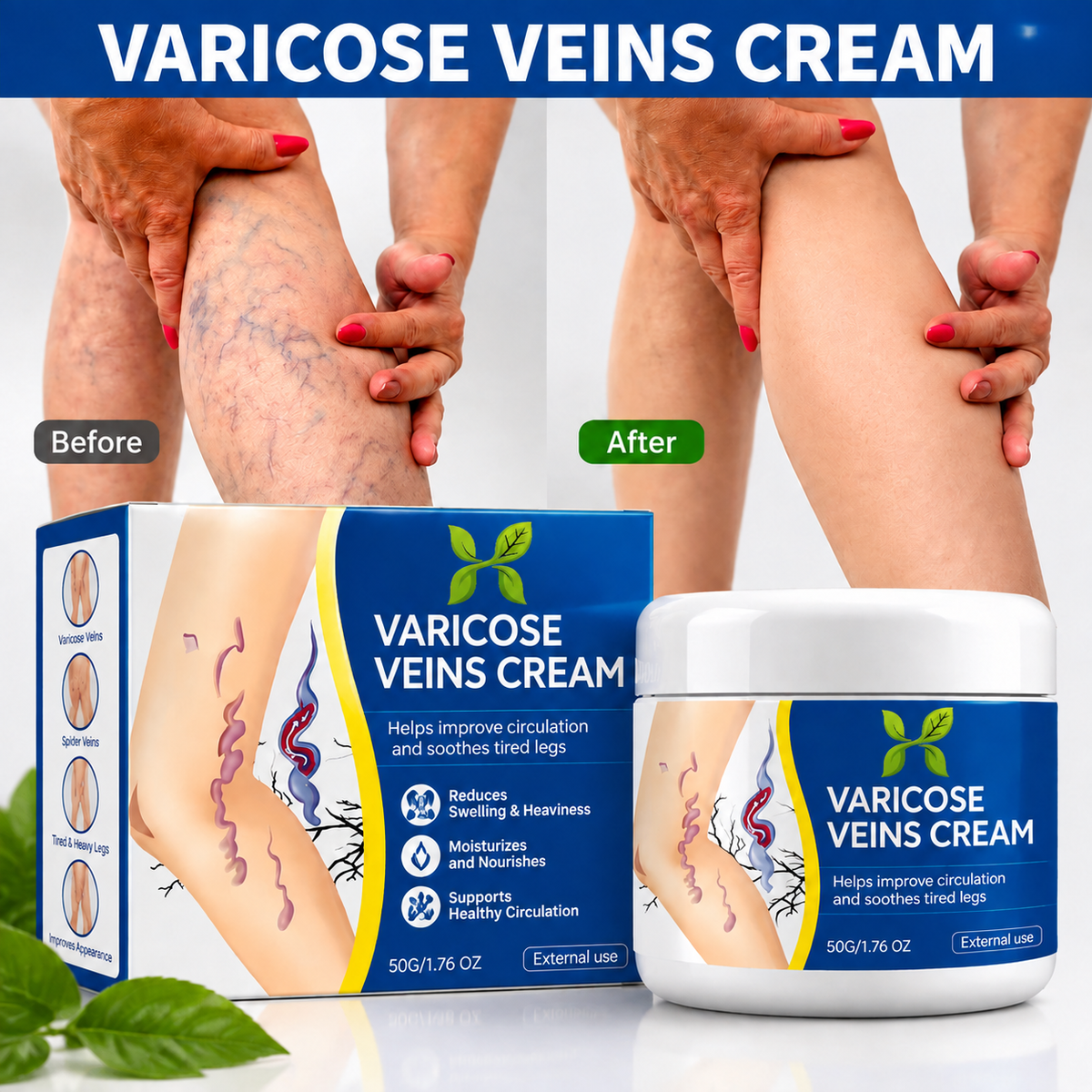 Herbal Varicose Veins Relief Cream