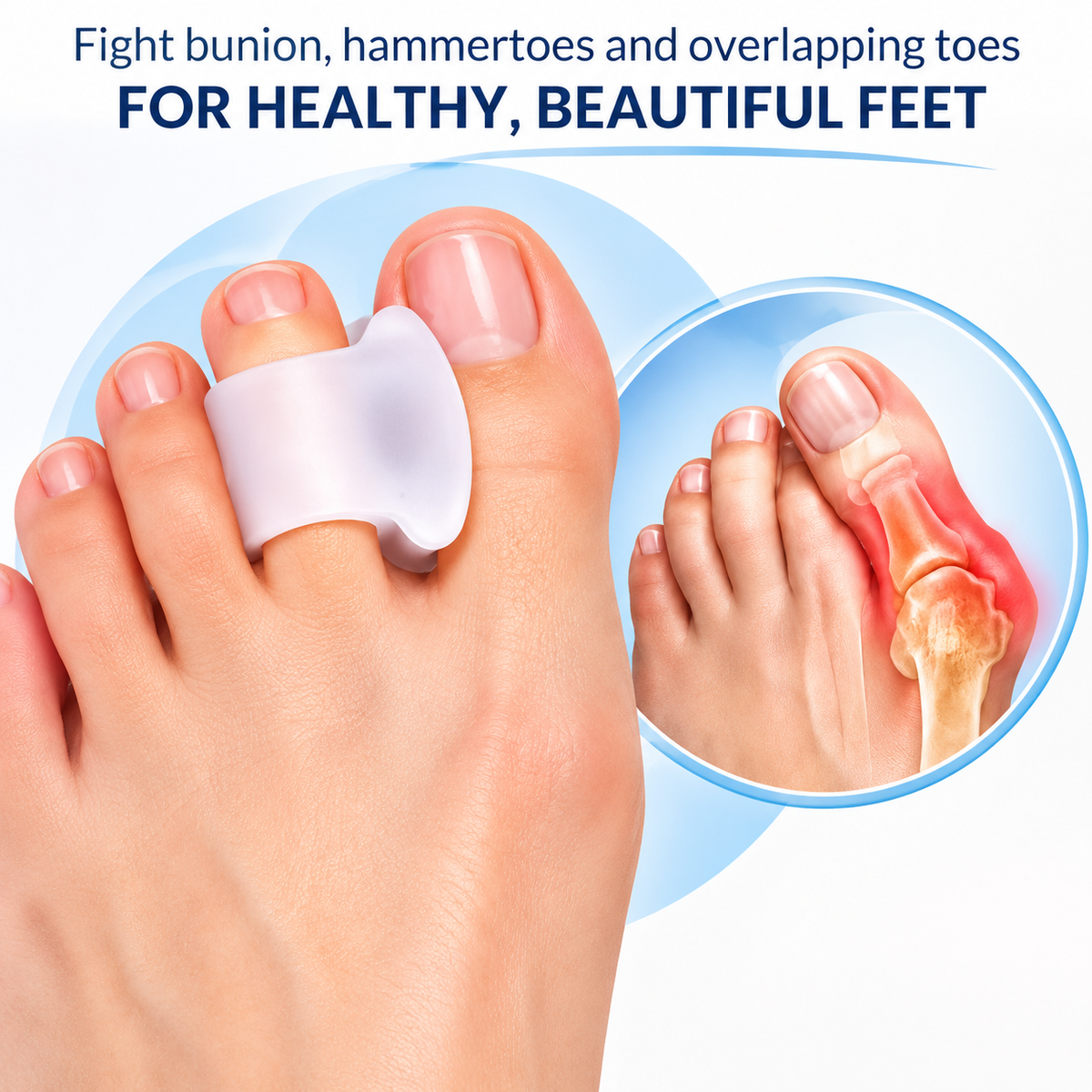Soft Bunion Corrector & Toe Spacer