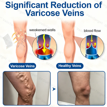 Varicose VeinTarget Microneedle Patch