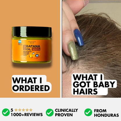 3-in-1 Batana Hair Oil For Hair Growth, Strength & Thickness