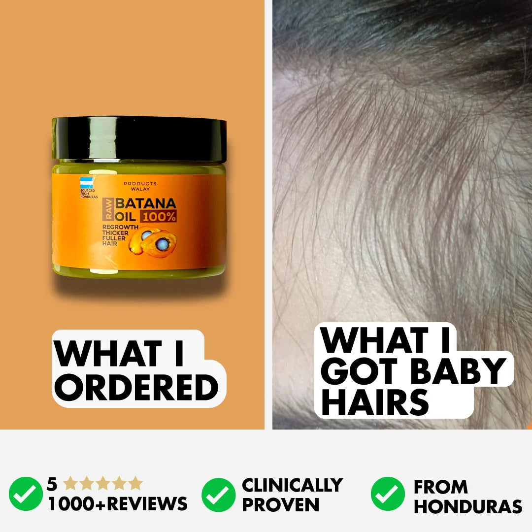 3-in-1 Batana Hair Oil For Hair Growth, Strength & Thickness